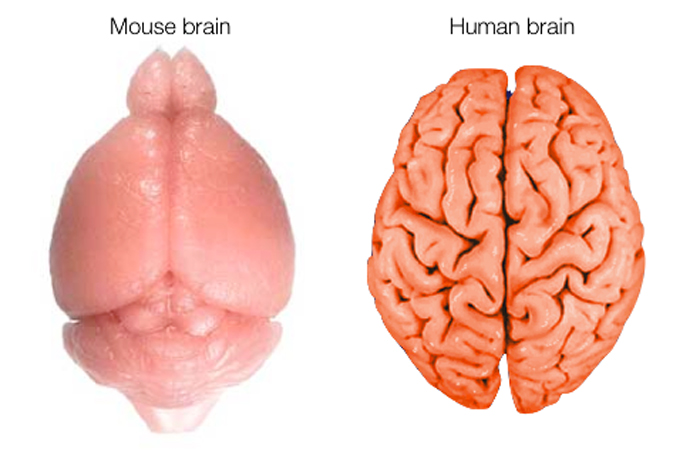 mouse brain vs human brain — scale comparison